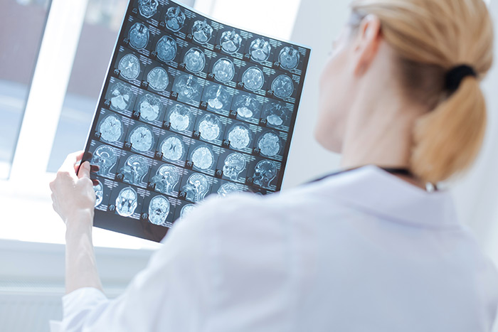 A doctor reading a brain scan report in a neurology clinic in Houston, TX